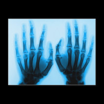 X Ray Eyes postcards