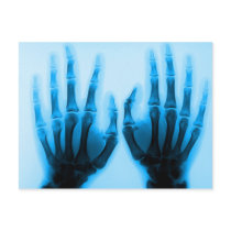 X Ray Eyes postcards