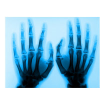 X Ray Eyes posters