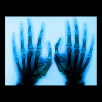 X-Ray Eyes posters