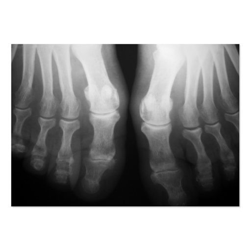 X-Ray Feet Human Skeleton Bones Black & White Business Card (back side)