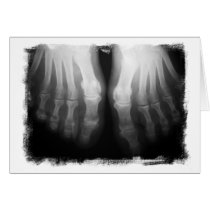 X-Ray Feet Human Skeleton Bones Black & White Cards