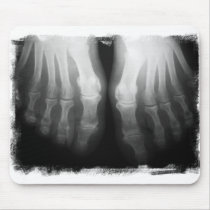 X-Ray Feet Human Skeleton Bones Black & White Mousepads