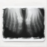 X-Ray Feet Human Skeleton Bones Black & White mousepads