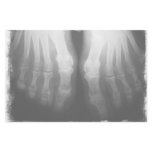 X-Ray Feet Human Skeleton Bones Black & White stationery