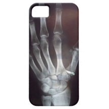 X Ray Hand Phone Case iPhone 5 Cover