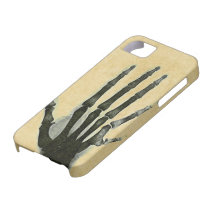 X-Ray Hand with Extra Finger Case-Mate Case iPhone 5 Cover