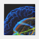 X-ray image of the brain fridge magnet