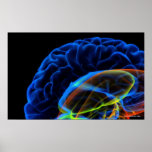X-ray image of the brain poster