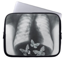 X-ray of butterflies in the stomach laptop computer sleeves