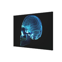 X-ray of the brain inside a skull canvas prints