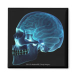 X-ray of the brain inside a skull refrigerator magnet