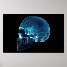 X-ray of the brain inside a skull print