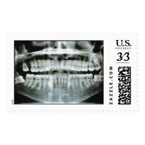 X-Ray postage