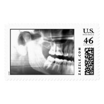 x ray postage stamp