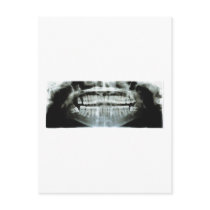 X-Ray postcards