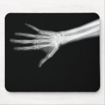 X-RAY SKELETON ARM B&W mousepads