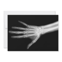 X-Ray Skeleton Arms Black & White Custom Invites