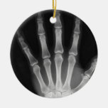 X-RAY SKELETON HAND FINGERS B&W CHRISTMAS TREE ORNAMENTS