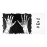 X-Ray Skeleton Hands & Jewelry - B&W photo cards