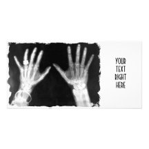 X-Ray Skeleton Hands & Jewelry - B&W Picture Card