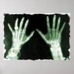 X-Ray Skeleton Hands & Jewelry - Green posters