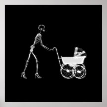 X-Ray Skeleton Mom & Baby - Original B&W Print