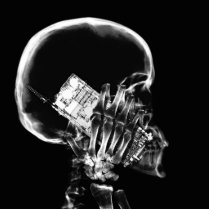 X-RAY SKELETON ON PHONE - B&W PHOTO CUT OUT