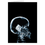 X-RAY SKELETON ON PHONE - BLUE CARDS