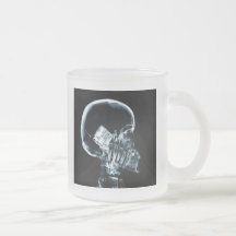 X-RAY SKELETON ON PHONE - BLUE COFFEE MUGS