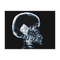 X-RAY SKELETON ON PHONE - BLUE POST CARDS