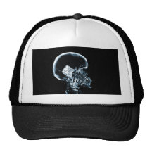 X-RAY SKELETON ON PHONE - BLUE TRUCKER HATS