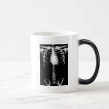 X-RAY SKELETON TORSO RIBS B&W COFFEE MUG