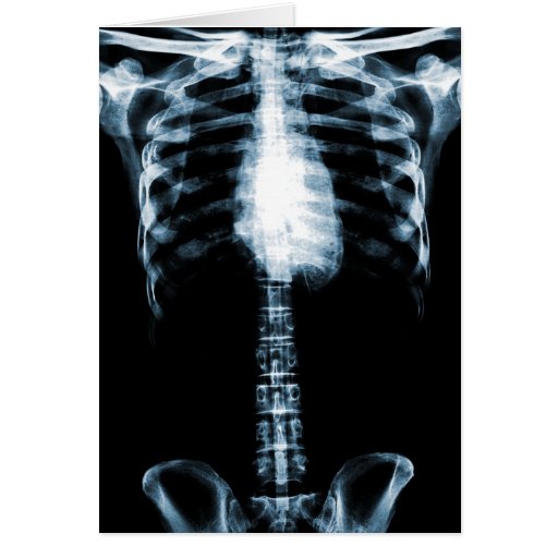 X-RAY SKELETON TORSO RIBS BLUE CARDS