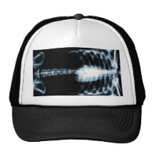 X-RAY SKELETON TORSO RIBS - BLUE MESH HATS