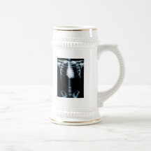 X-RAY SKELETON TORSO RIBS BLUE MUG