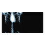 X-RAY SKELETON TORSO RIBS - BLUE PERSONALIZED PHOTO CARD