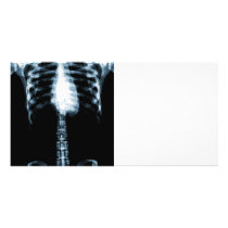 X-RAY SKELETON TORSO RIBS - BLUE PHOTO GREETING CARD