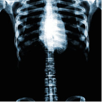 X-RAY SKELETON TORSO RIBS - BLUE ACRYLIC CUT OUTS