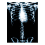 X-RAY SKELETON TORSO RIBS BLUE POSTCARD