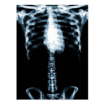 X-RAY SKELETON TORSO RIBS BLUE POSTCARD