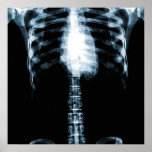 X-RAY SKELETON TORSO RIBS - BLUE PRINT