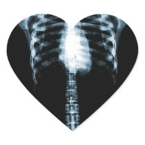 X-RAY SKELETON TORSO RIBS - BLUE HEART STICKERS