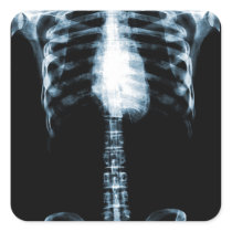 X-RAY SKELETON TORSO RIBS - BLUE SQUARE STICKERS