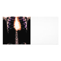 X-RAY SKELETON TORSO RIBS - ORIGINAL PICTURE CARD