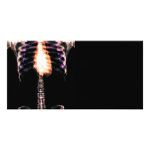 X-RAY SKELETON TORSO RIBS - ORIGINAL PERSONALIZED PHOTO CARD