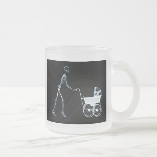 X-RAY SKELETON WOMAN & BABY CARRIAGE - BLUE COFFEE MUGS