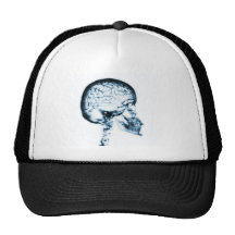 X-RAY SKULL BRAIN - BLUE HAT
