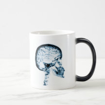X-RAY SKULL BRAIN - BLUE MUGS
