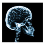 X-RAY SKULL BRAIN - BLUE POSTERS
